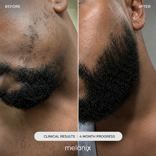 Melanix Beard Growth Kit - GHK-Cu & Adenosine