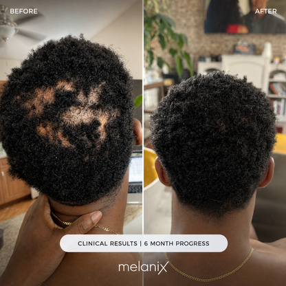 Hair Regrowth 2.0 Adenosine & GHK-Cu Micro-Infusion System
