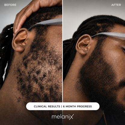 Hair Regrowth 2.0 Adenosine & GHK-Cu Micro-Infusion System