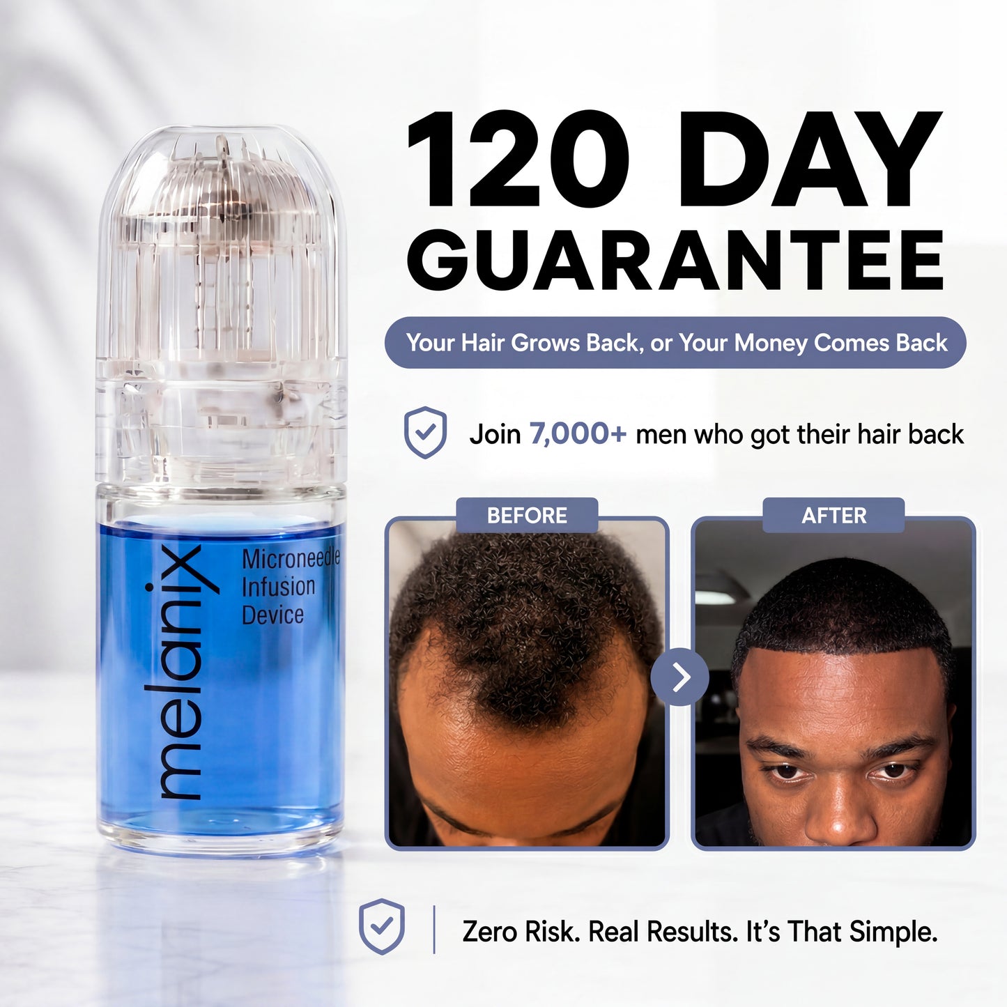 Hair Regrowth 2.0 Adenosine & GHK-Cu Micro-Infusion System